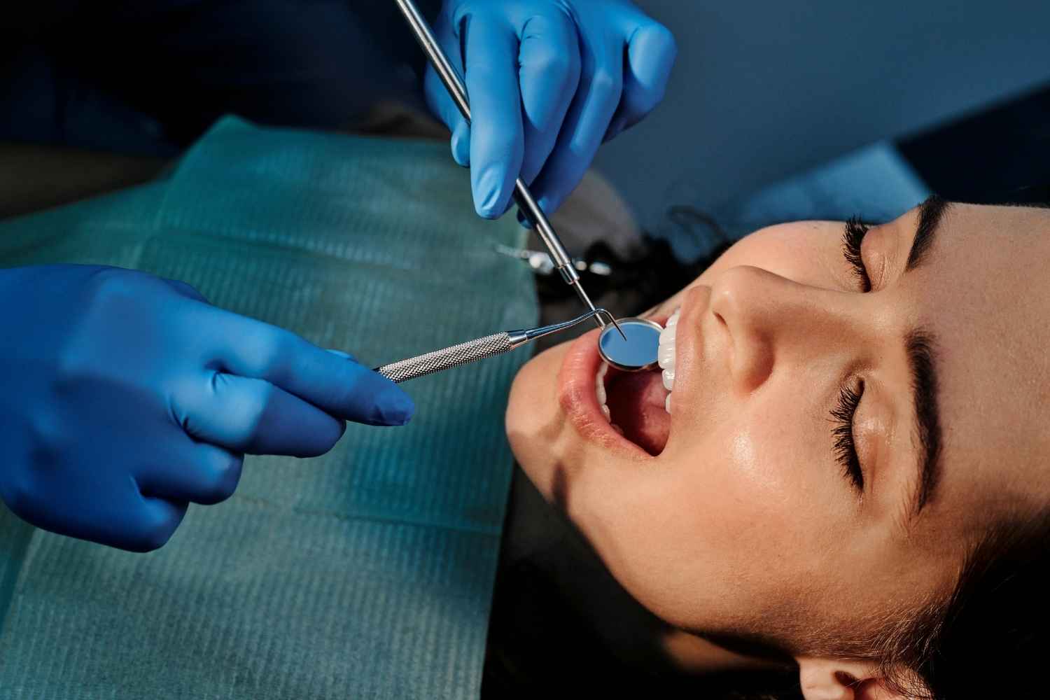 נסיגת חניכיים - גורמים, תסמינים ודרכי טיפול